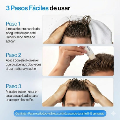 Sérum Capilar Bodywise™ Roll-On con Romero - Paga al recibir + Envío Gratis 🏠🚗🔥